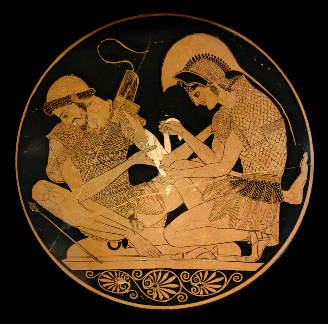 a depiction of achilles and his heel